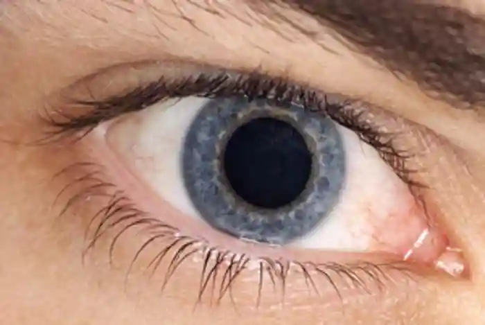 Image of an eye showing a dilated or enlarged pupil - one of the effects of adrenaline released during a &amp;#x27;fight or flight&amp;#x27; response.