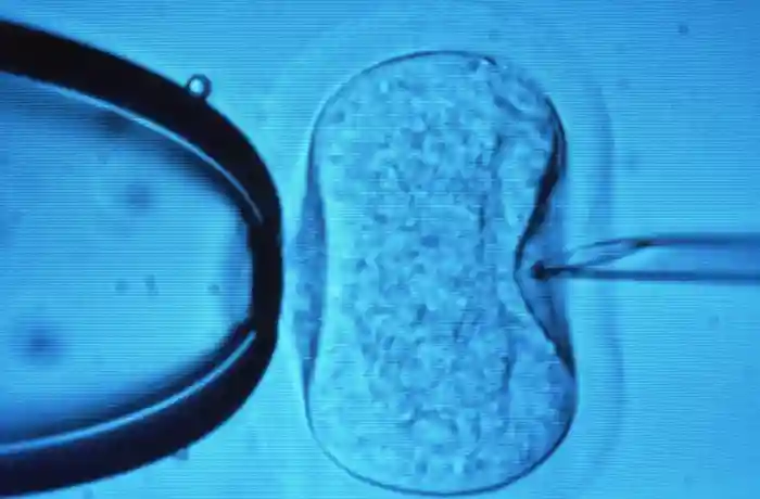 A light microscope image showing the process of in vitro fertilisation (IVF). A needle (right) is being used to inject a sperm cell directly into a human egg (centre). A pipette (left) is used to hold the egg steady while the needle is inserted.