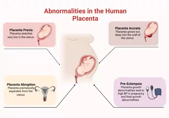 Abnormalities In Human Placenta