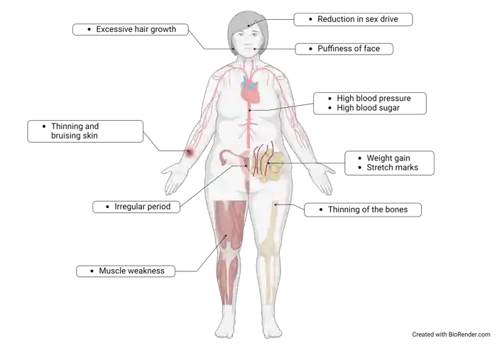 Figure 2 Final